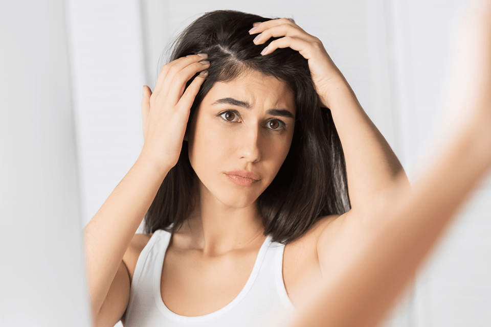 hair balms for dry scalp